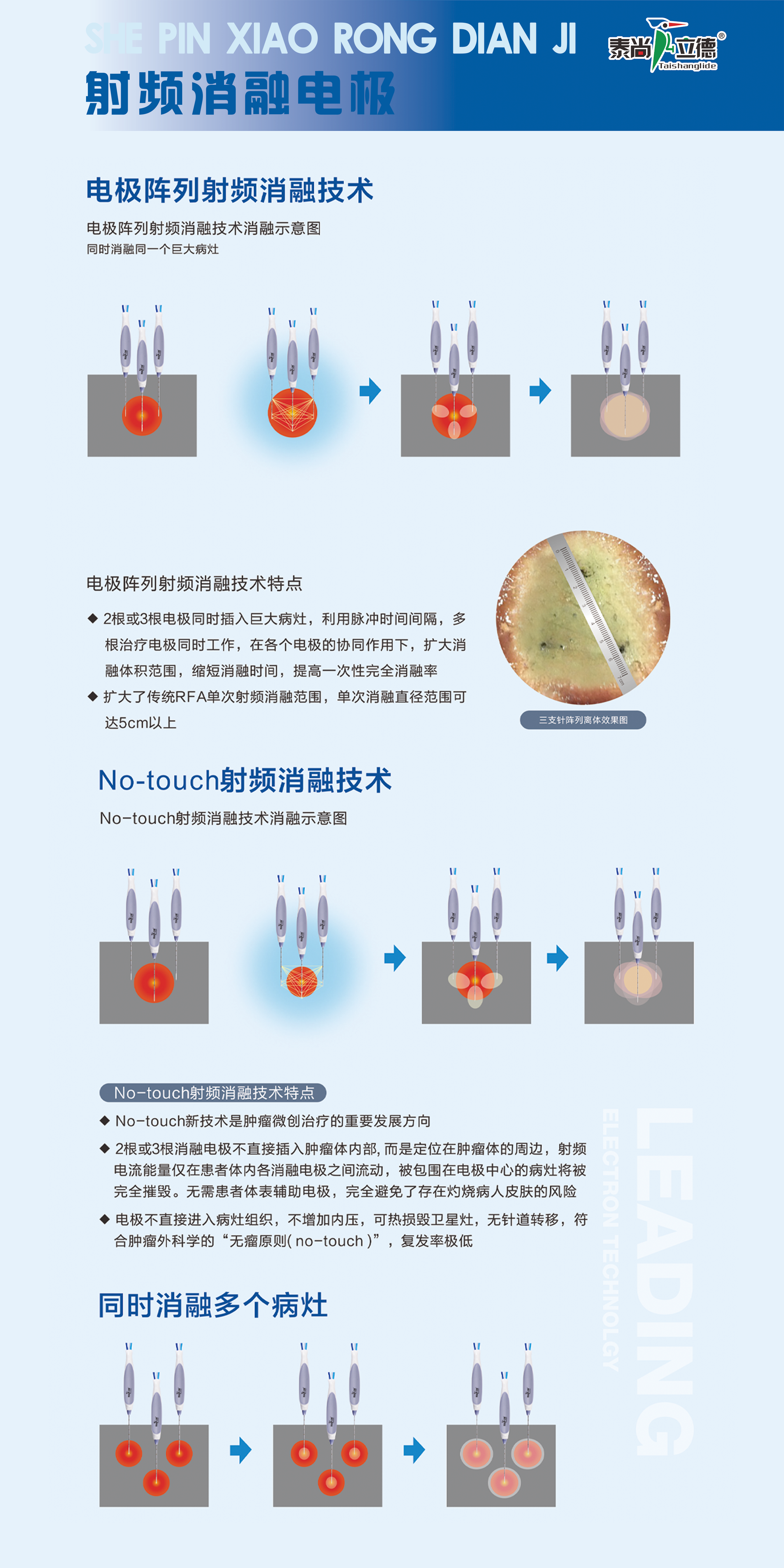 射頻消融電極 技術(shù)特點(diǎn)