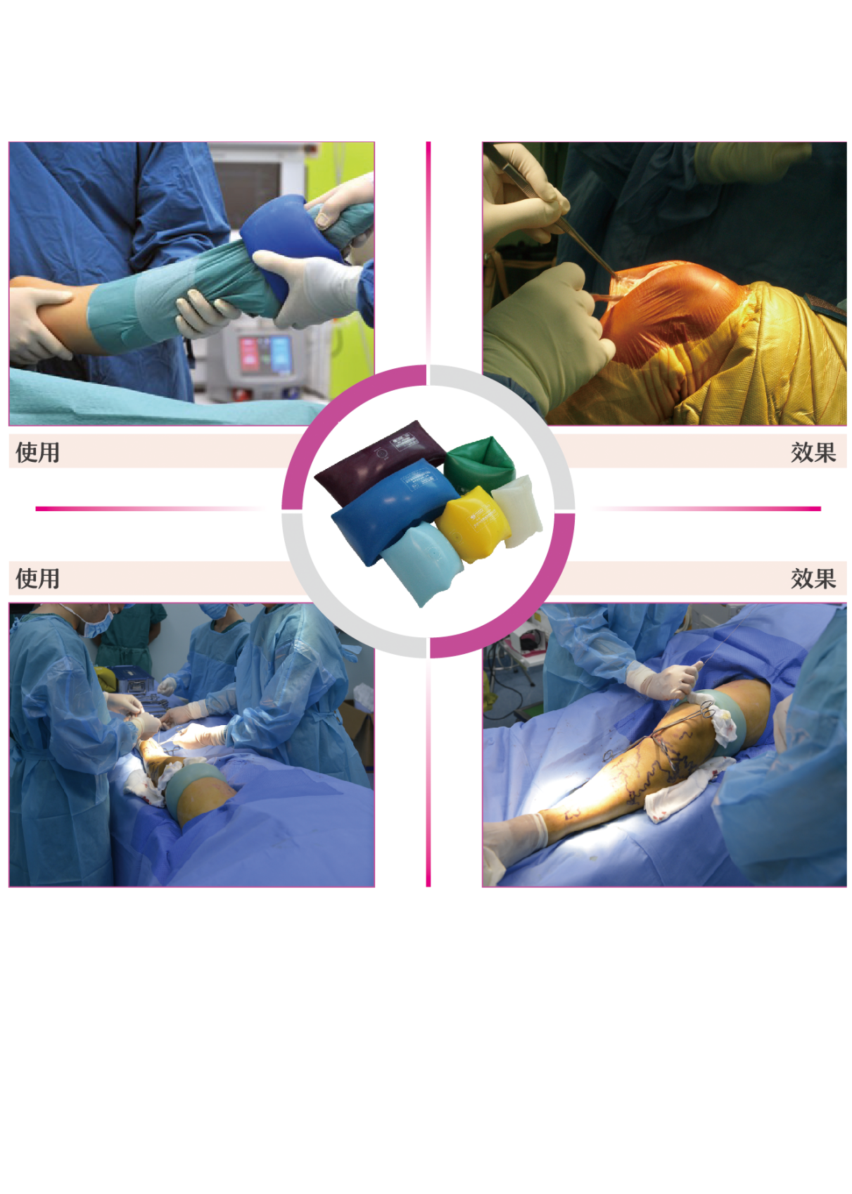 驅血器（肢體壓力套）：主要針對手術室的產品。