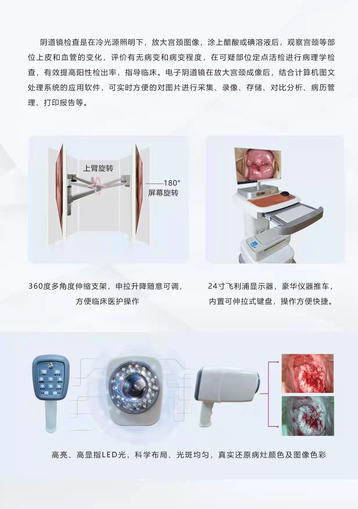 數碼電子陰道鏡產品說明