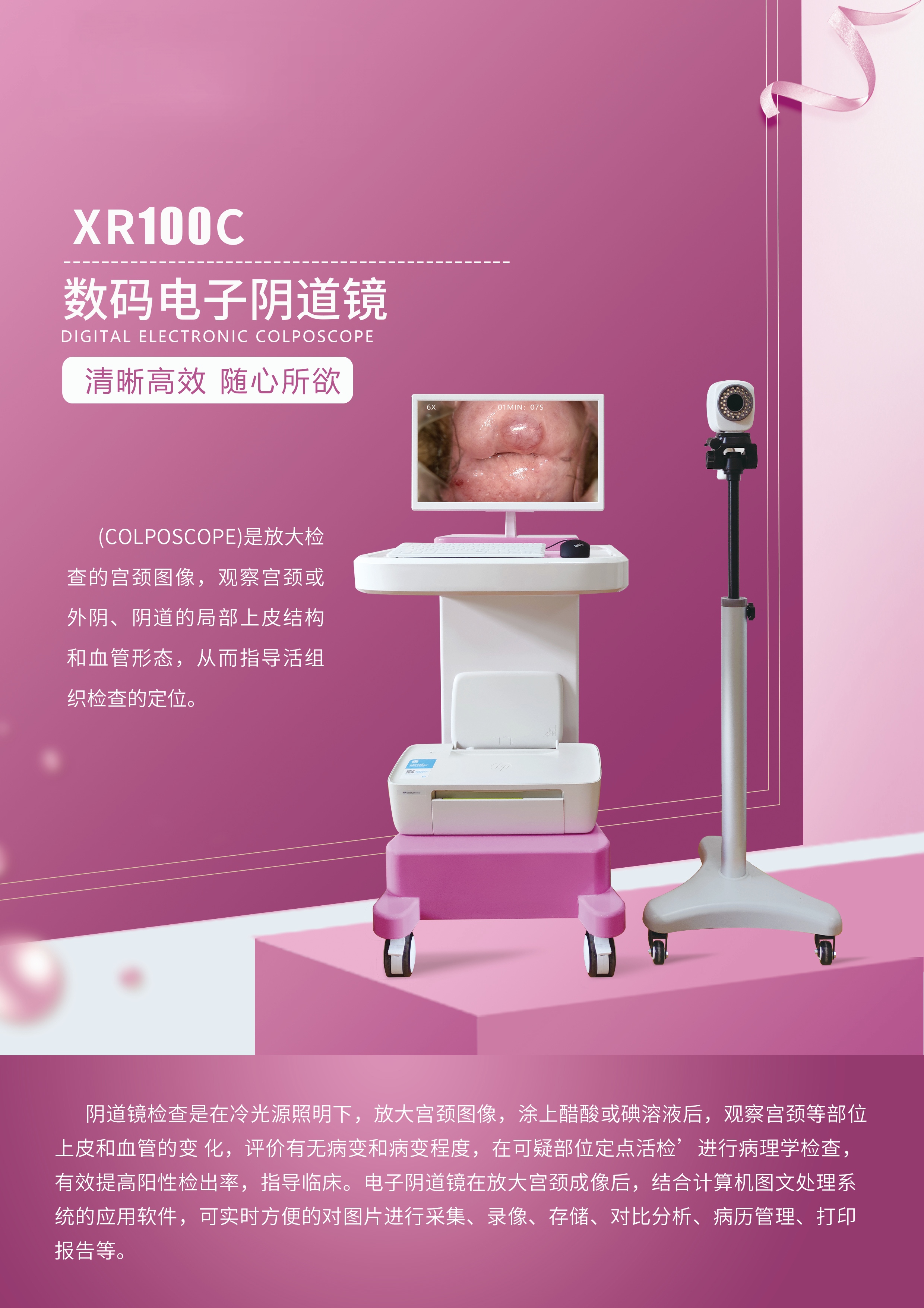 數碼電子陰道鏡